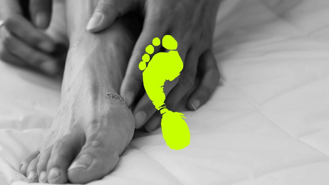 Do I Have Eczema or Athlete’s Foot?