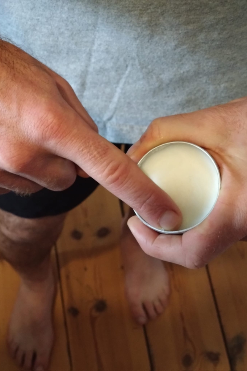 Athlete’s Foot on Hands (Tinea Manuum): Causes, Prevention & Treatment ...